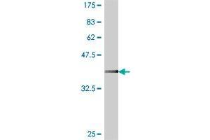 Western Blot detection against Immunogen (37. (RPS20 anticorps  (AA 20-119))