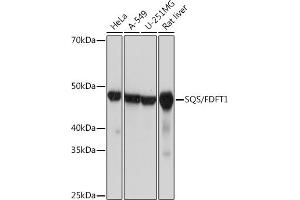 Western blot analysis of extracts of various cell lines, using SQS/FDFT1 Rabbit mAb (ABIN7267130) at 1:1000 dilution. (FDFT1 anticorps)