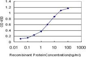 Detection limit for recombinant GST tagged RORB is approximately 0. (RORB anticorps  (AA 136-224))