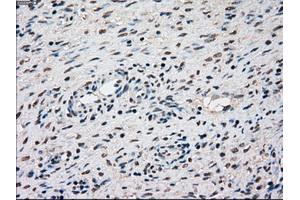 Immunohistochemical staining of paraffin-embedded Kidney tissue using anti-SSBmouse monoclonal antibody. (SSB anticorps)