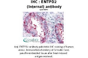 Image no. 2 for anti-Ectonucleoside Triphosphate diphosphohydrolase 2 (ENTPD2) (Internal Region) antibody (ABIN1734055) (ENTPD2 anticorps  (Internal Region))