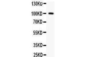 Anti- F2 antibody, Western blotting All lanes: Anti F2  at 0. (Prothrombin anticorps  (C-Term))