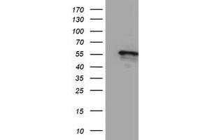 HEK293T cells were transfected with the pCMV6-ENTRY control (Left lane) or pCMV6-ENTRY CYP2A6 (Right lane) cDNA for 48 hrs and lysed. (CYP2A6 anticorps)