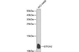 Western blot analysis of extracts of NCI-H460 cells, using GTF2 antibody  at 1:1000 dilution. (GTF2A2 anticorps  (AA 1-109))