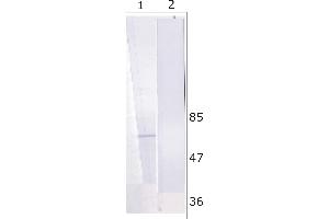 WB analysis of Huh-7 cell line expressing NS5B protein. (HCV 1b NS5B anticorps  (AA 92-105))