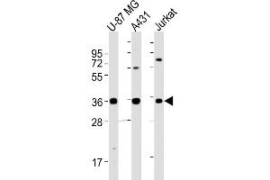 Western Blotting (WB) image for anti-MHC Class I Polypeptide-Related Sequence A (MICA) (AA 68-97) antibody (ABIN652566)