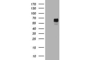 Image no. 2 for anti-Tyrosinase (TYR) (AA 19-320) antibody (ABIN1491083) (TYR anticorps  (AA 19-320))