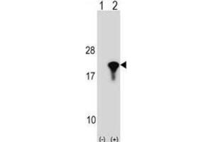 Western Blotting (WB) image for anti-Peptidylprolyl Isomerase (Cyclophilin)-Like 1 (PPIL1) antibody (ABIN2998971) (PPIL1 anticorps)