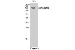 Western Blotting (WB) image for anti-PR (pSer294) antibody (ABIN3173167) (PR (pSer294) anticorps)
