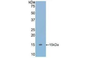 Detection of Recombinant TGFb1, Human using Polyclonal Antibody to Transforming Growth Factor Beta 1 (TGFb1) (TGFB1 anticorps  (AA 279-390))