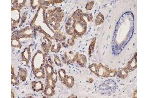 Immunohistochemistry (IHC) image for anti-Keratin 8 (KRT8) (C-Term) antibody (ABIN870549) (KRT8 anticorps  (C-Term))