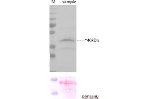 Sample preparation and immunoblot analysis were carried out as described in Karnik et al. (YFP anticorps  (C-Term))