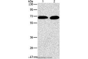 Western blot analysis of Jurkat and NIH/3T3 cell, using PRKCA Polyclonal Antibody at dilution of 1:500 (PKC alpha anticorps)