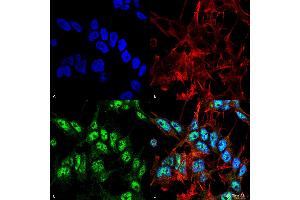 Immunocytochemistry/Immunofluorescence analysis using Rabbit Anti-Beclin 1 Polyclonal Antibody . (Beclin 1 anticorps  (APC))