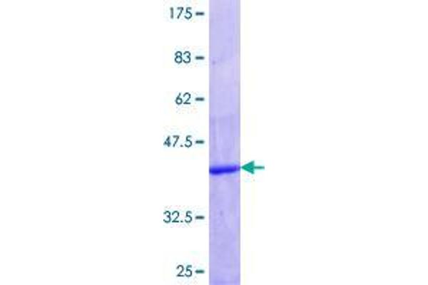 Fission 1 Protein (FIS1) (AA 1-100) (GST tag)