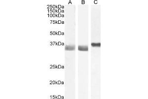 Western Blotting (WB) image for anti-Glyceraldehyde-3-Phosphate Dehydrogenase (GAPDH) (C-Term) antibody (ABIN185240)