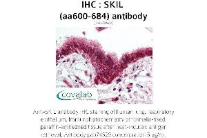 Image no. 1 for anti-SKI-Like Oncogene (SKIL) (AA 600-684) antibody (ABIN1739313) (SKIL anticorps  (AA 600-684))