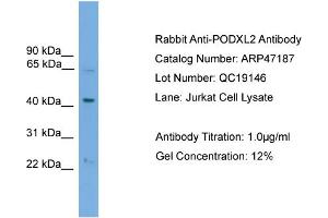 WB Suggested Anti-PODXL2  Antibody Titration: 0. (PODXL2 anticorps  (N-Term))