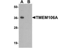 Western blot analysis of TMEM106A in A-20 cell lysate with TMEM106A Antibody  at 1 µg/ml in (A) the absence and (B) the presence of blocking peptide. (TMEM106A anticorps  (N-Term))