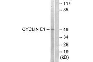 Western blot analysis of extracts from HeLa cells, treated with Paclitaxel 1uM 60', using Cyclin E1 (Ab-395) Antibody. (Cyclin E1 anticorps  (AA 361-410))