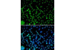 Immunofluorescence analysis of HeLa cells using IRF2 antibody. (IRF2 anticorps)