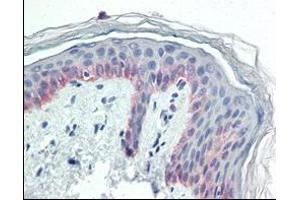 Immunohistochemical analysis of paraffin-embedded human skin tissues using CK5 antibody. (Cytokeratin 5 anticorps)