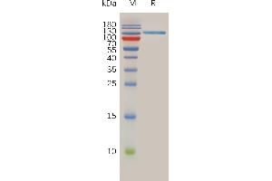 Human S Protein, hFc Tag on SDS-PAGE under reducing condition. (SPAM1 Protein (AA 36-482) (Fc Tag))