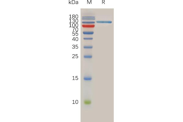 SPAM1 Protein (AA 36-482) (Fc Tag)