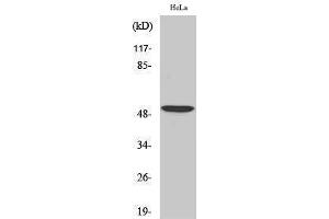 Western Blotting (WB) image for anti-Activating Transcription Factor 2 (ATF2) (Ser220), (Ser259) antibody (ABIN3179881) (ATF2 anticorps  (Ser220, Ser259))