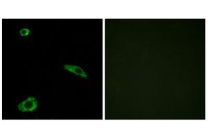 Immunofluorescence analysis of MCF-7 cells, using ACTHR antibody. (MC2R anticorps  (C-Term))