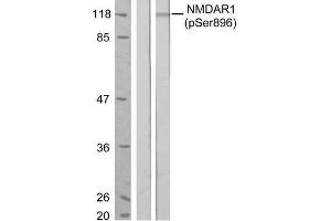 Western blot analysis of extract from MCF7 cells, untreated or treated with estradiol (100nM, 20min), using NMDAR1 (phospho-Ser896) antibody (E011104). (GRIN1/NMDAR1 anticorps  (pSer896))