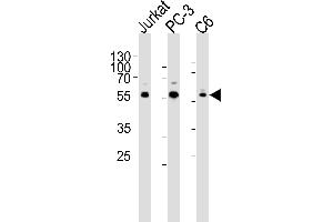Western blot analysis of lysates from Jurkat, PC-3, C6 cell line (from left to right), using AKT1/2/3 Antibody (Center) (ABIN6244286 and ABIN6577440). (AKT 1/2/3 anticorps  (AA 278-312))