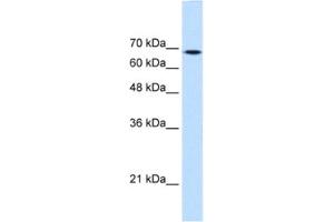 Western Blotting (WB) image for anti-Transglutaminase 2 (C Polypeptide, Protein-Glutamine-gamma-Glutamyltransferase) (TGM2) antibody (ABIN2463067) (Transglutaminase 2 anticorps)