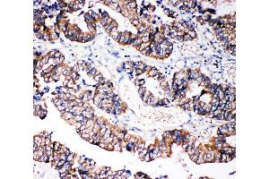 Immunohistochemistry (IHC) image for anti-Caspase 3 (CASP3) (AA 220-236), (C-Term) antibody (ABIN3044357)