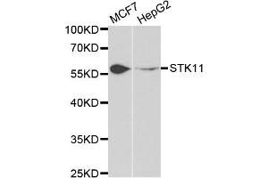 Western blot analysis of extracts of MCF7 and HepG2 cell lines, using STK11 antibody. (LKB1 anticorps)