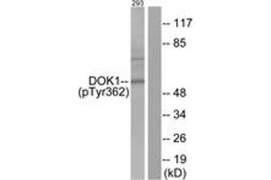 Western Blotting (WB) image for anti-Docking Protein 1, 62kDa (Downstream of tyrosine Kinase 1) (DOK1) (pTyr362) antibody (ABIN2888393) (DOK1 anticorps  (pTyr362))