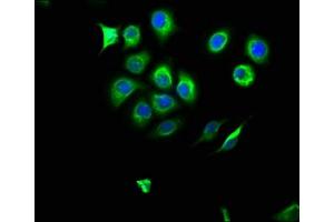 Immunofluorescence staining of A549 cells with ABIN7161627 at 1:166, counter-stained with DAPI. (NOS2 anticorps  (AA 17-141))