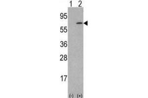 Western Blotting (WB) image for anti-Colony Stimulating Factor 1 (Macrophage) (CSF1) antibody (ABIN3002787) (M-CSF/CSF1 anticorps)