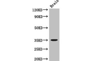 Western Blot Positive WB detected in: Mouse brain tissue All lanes: MYOD1 antibody at 3 μg/mL Secondary Goat polyclonal to rabbit IgG at 1/50000 dilution Predicted band size: 35 kDa Observed band size: 35 kDa (MYOD1 anticorps  (AA 116-320))