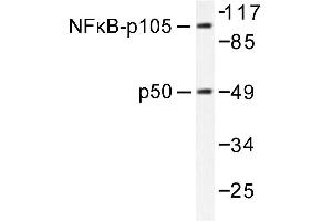 Image no. 2 for anti-Nuclear Factor of kappa Light Polypeptide Gene Enhancer in B-Cells 1 (NFKB1) antibody (ABIN271744) (NFKB1 anticorps)