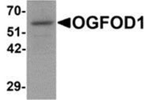 Western blot analysis of OGFOD1 in Daudi cell lysate with OGFOD1 antibody at 1 μg/ml. (OGFOD1 anticorps  (C-Term))