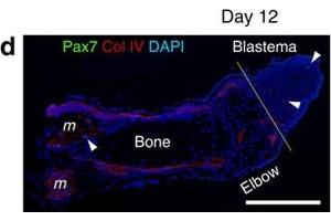 Immunofluorescence (Paraffin-embedded Sections) (IF (p)) image for anti-Collagen, Type IV (COL4) antibody (ABIN5596835)