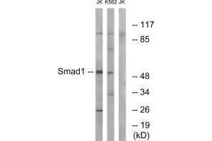 Western blot analysis of extracts from JK and K562 cells, using Smad1 (Ab-187) antibody. (SMAD1 anticorps  (Ser187))