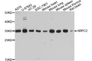Western blot analysis of extracts of various cell lines, using ARPC2 antibody. (ARPC2 anticorps)