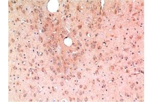 Immunohistochemical analysis of paraffin-embedded Rat Brain Tissue using TGFβ1 Mouse mAb diluted at 1:200. (TGFB1 anticorps)