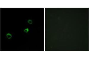 Image no. 2 for anti-Cytochrome B-561 Domain Containing 1 (CYB561D1) (AA 180-229) antibody (ABIN2889869) (CYB561D1 anticorps  (AA 180-229))