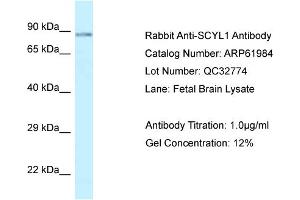 Western Blotting (WB) image for anti-SCY1-Like 1 (SCYL1) (C-Term) antibody (ABIN786532) (SCYL1 anticorps  (C-Term))