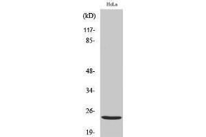 Western Blotting (WB) image for anti-Protein Phosphatase 1, Regulatory (Inhibitor) Subunit 14D (PPP1R14D) (Internal Region) antibody (ABIN6283823) (PPP1R14D anticorps  (Internal Region))