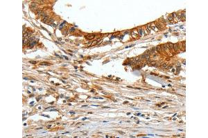 Immunohistochemistry (IHC) image for anti-Collagen, Type I, alpha 2 (COL1A2) antibody (ABIN2421212) (COL1A2 anticorps)