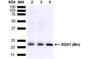 Western blot analysis of Mouse Brain, Rat Brain, and Rat Brain Membrane showing detection of 24. (SOD2 anticorps  (HRP))